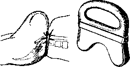 Postpartum Period: figure 9 from the 1928–1936 encyclopedia article