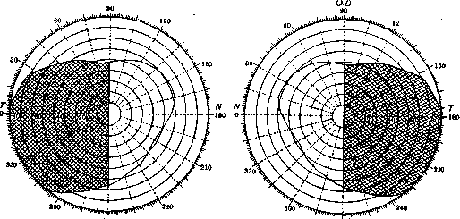 Hemianopsia: figure 4 from the 1928–1936 encyclopedia article