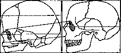 Facial Nerve (FACIAL NERVE, see Facialis): figure 4 from the 1928–1936 encyclopedia article