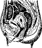 Contraceptives: figure 30 from the 1928–1936 encyclopedia article