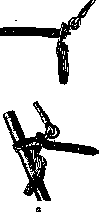 Prostheses: figure 15 from the 1928–1936 encyclopedia article