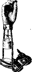 Prostheses: figure 6 from the 1928–1936 encyclopedia article