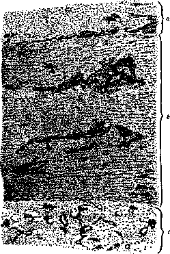 Aorta: figure 10 from the 1928–1936 encyclopedia article