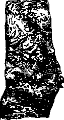 Aorta: figure 9 from the 1928–1936 encyclopedia article