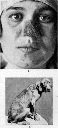 Leishmaniases: figure 5 from the 1928–1936 encyclopedia article