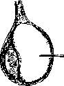 Hydrocele: figure 1 from the 1928–1936 encyclopedia article