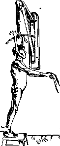 Spondylitis: figure 23 from the 1928–1936 encyclopedia article