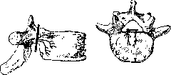 Spondylitis: figure 6 from the 1928–1936 encyclopedia article