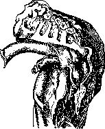 Spondylitis: figure 10 from the 1928–1936 encyclopedia article