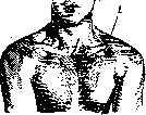 Mohrenheim's Fossa and Moria: figure 1 from the 1928–1936 encyclopedia article