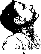 Tics: figure 1 from the 1928–1936 encyclopedia article
