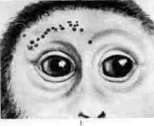 Bartonella: figure 1 from the 1928–1936 encyclopedia article