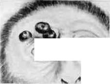 Bartonella: figure 4 from the 1928–1936 encyclopedia article